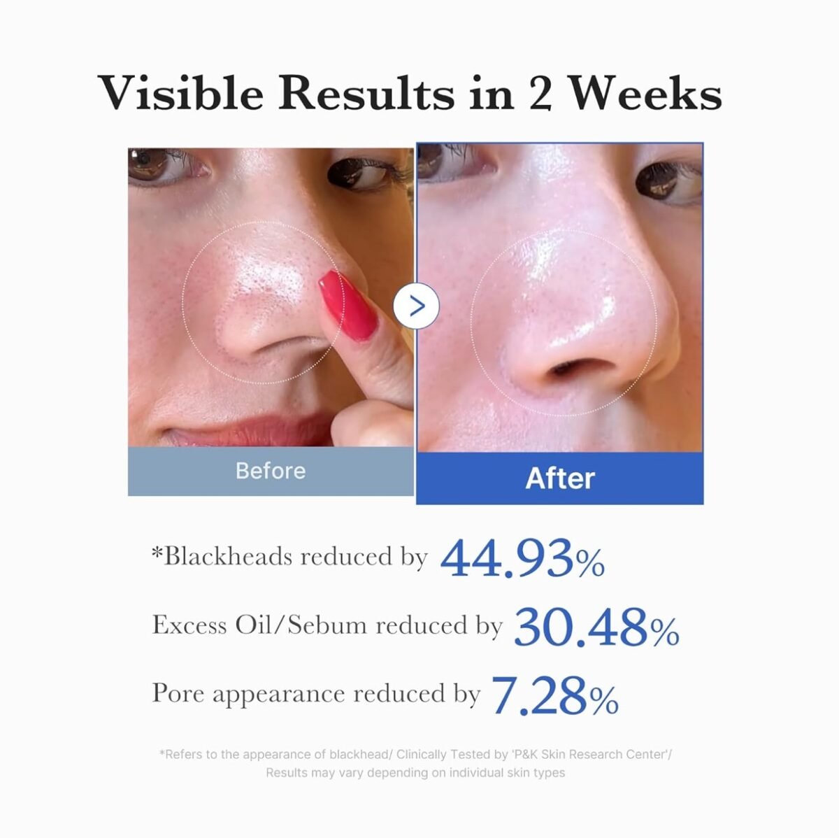 Medicube Zero Pore Pad 2.0 (70ea) - Image 5